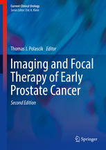 Imaging And Focal Therapy Of Early Prostate Cancer 2nd Edition Thomas J Polascik Eds