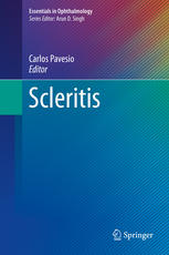 Scleritis 1st Edition Carlos Pavesio Eds