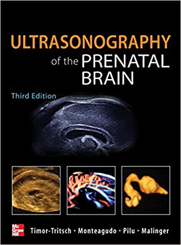 Ultrasonography Of The Prenatal Brain 3rd Edition Ilan Timortritsch