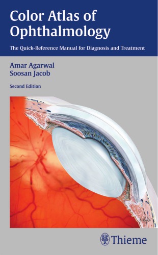 Color Atlas Of Ophthalmology The Quickreference Manual For Diagnosis And Treatment 2nd Amar Agarwal