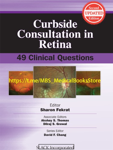 Curbside Consultation In Retina 49 Clinical Questions 2nd Edition Sharon Fekrat