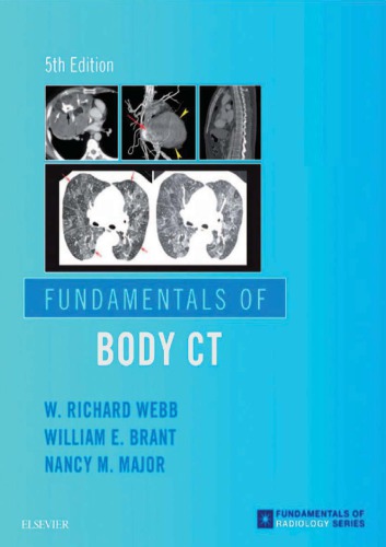 Fundamentals Of Body Ct 5th Edition W Richard Webb Wiliam Brant