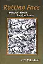 Rotting Face Smallpox And The American Indian 1st R G Robertson