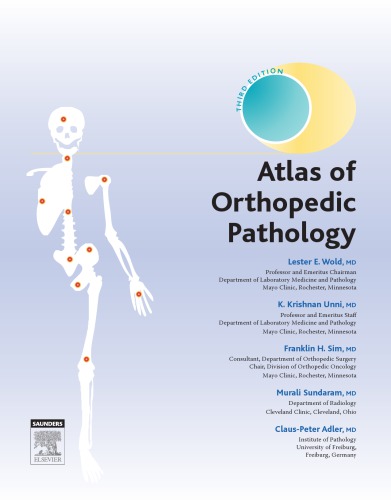 Atlas Of Orthopedic Pathology 3rd Lester E Wold Et Al