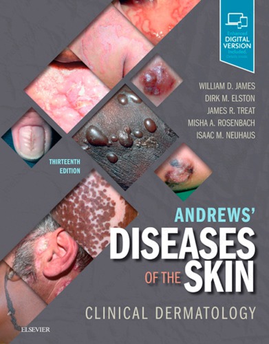 Andrews Diseases Of The Skin Clinical Dermatology 13th William D James