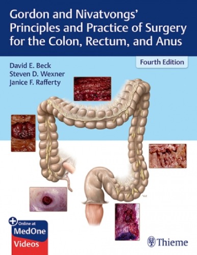 Gordon And Nivatvongs Principles And Practice Of Surgery For The Colon Rectum And Anus 4th Edition David Beck