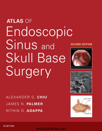Atlas Of Endoscopic Sinus And Skull Base Surgery 2nd Edition Alexander Chiu