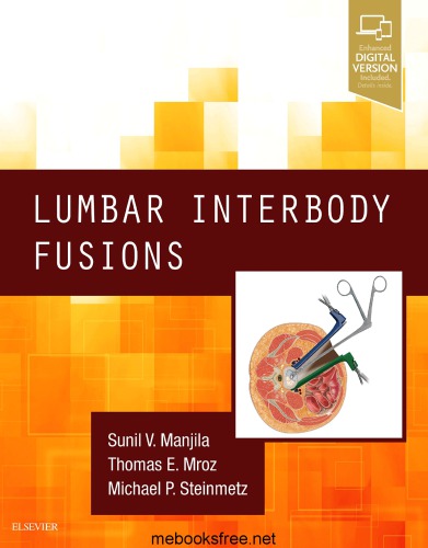 Lumbar Interbody Fusions 1st Edition Sunil Manjila Thomas Mroz