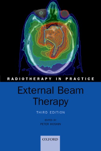 External Beam Therapy Peter Hoskin