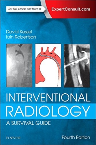 Interventional Radiology A Survival Guide 4th David Kessel Iain Robertson