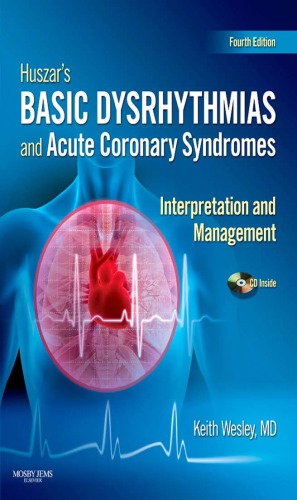 Huszars Basic Dysrhythmias And Acute Coronary Syndromes Interpretation And Management Text Pocket Guide Package Ebook Ebook Keith Wesley