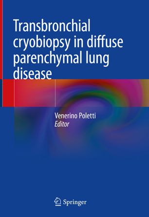 Transbronchial Cryobiopsy In Diffuse Parenchymal Lung Disease 1st Ed Venerino Poletti
