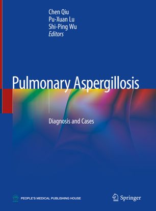 Pulmonary Aspergillosis Diagnosis And Cases 1st Ed Chen Qiu