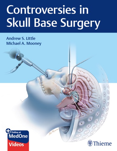 Controversies In Skull Base Surgery Hardcover Andrew S Little Michael A Mooney