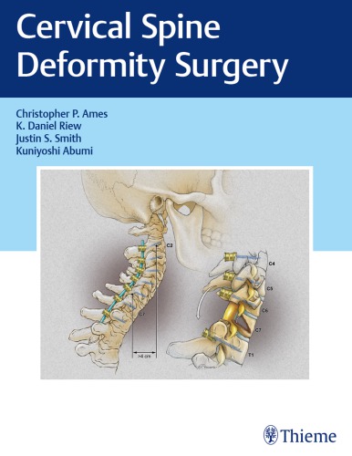 Cervical Spine Deformity Surgery Hardcover Christopher P Ames K Daniel Riew Justin S Smith Kuniyoshi Abumi