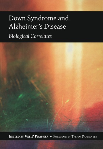 Down Syndrome And Alzheimers Disease Biological Correlates Prasher