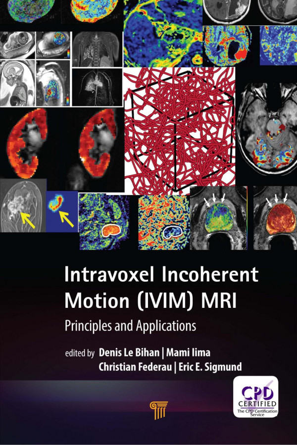 Intravoxel Incoherent Motion Ivim Mri Principles And Applications Federau