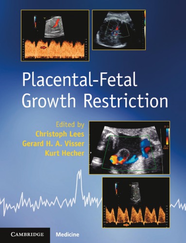 Placentalfetal Growth Restriction Christoph Lees Gerard H A Visser