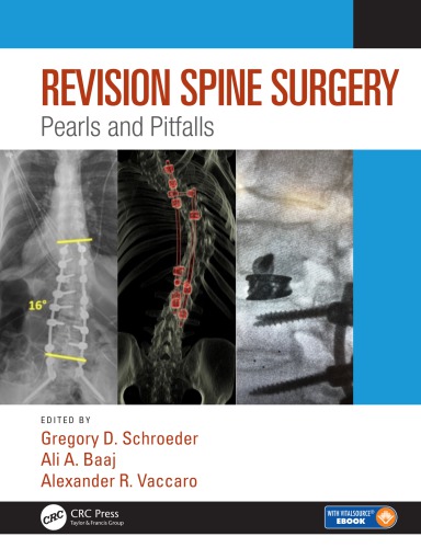 Revision Spine Surgery Pearls And Pitfalls Gregory D Schroeder Ali A Baaj Alexander R Vaccaro