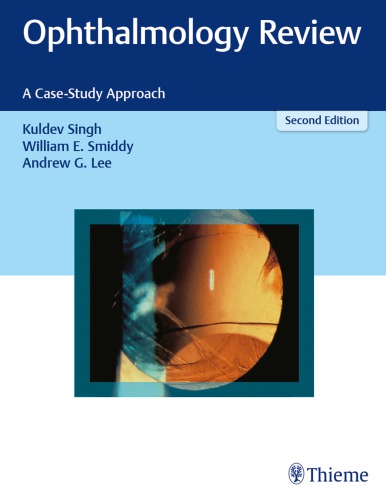 Ophthalmology Review A Casestudy Approach 2nd Edition Kuldev Singh