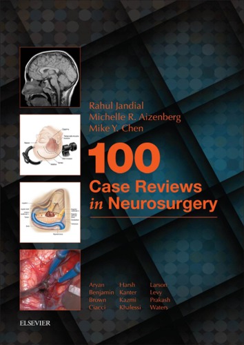 100 Case Reviews In Neurosurgery 1st Rahul Jandial Michele Aizenberg