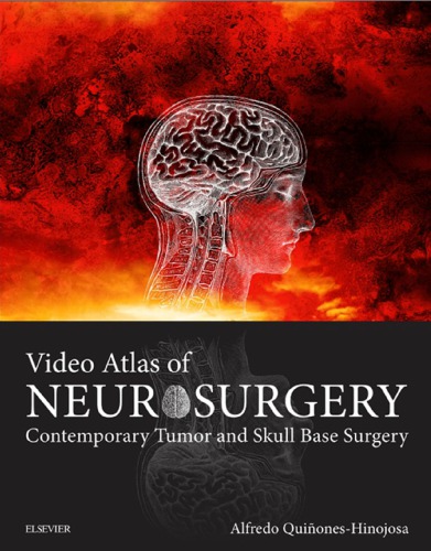 Video Atlas Of Neurosurgery Contemporary Tumor And Skull Base Surgery 1st Edition Alfredo Quinoneshinojosa