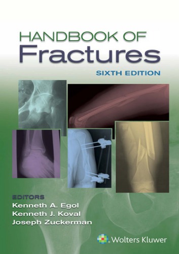 Handbook Of Fractures 6th Edition Kenneth Egol
