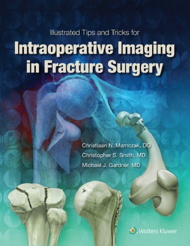 Illustrated Tips And Tricks For Intraoperative Imaging In Fracture Surgery 1st Michael J Gardner
