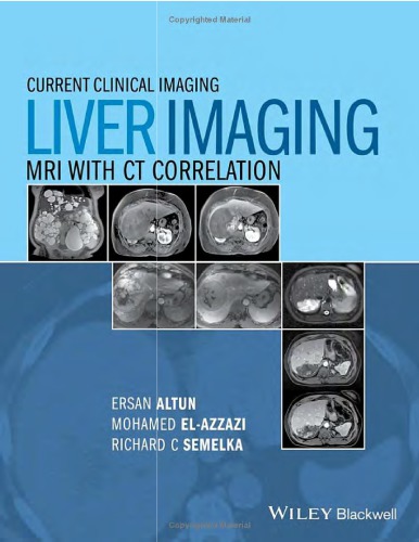 Liver Imagaing Mri With Ct Correlation Ersan Altun Mohamed Elazzazi Richard C Semelka Larissa Braga
