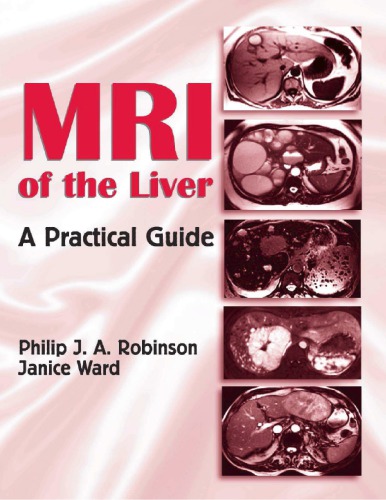 Mri Of The Liver A Practical Guide Hardcover Philip Ja Robinson