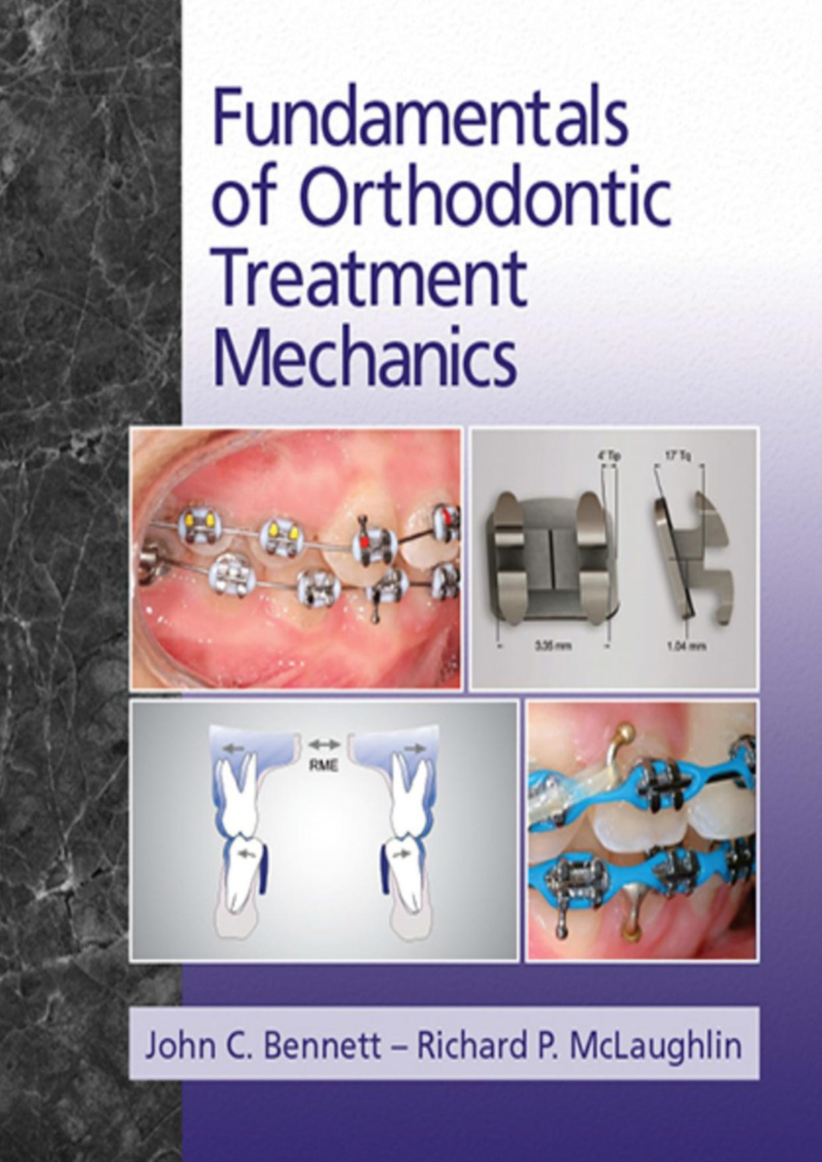 Fundamentals Of Orhodontic Treatment Mechanics John C Bennett Richard P Mclaughlin