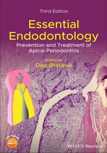 Essential Endodontology Prevention And Treatment Of Apical Periodontitis 3rd Edition Dag Orstavik