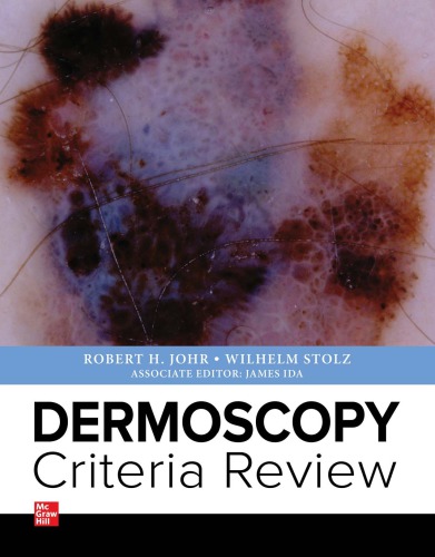 Dermoscopy Criteria Review 1st Robert Johr Wilhelm Stolz