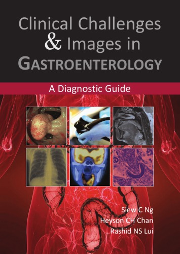 Clinical Challenges Images In Gastroenterology A Diagnostic Guide 1st Siew C Ng