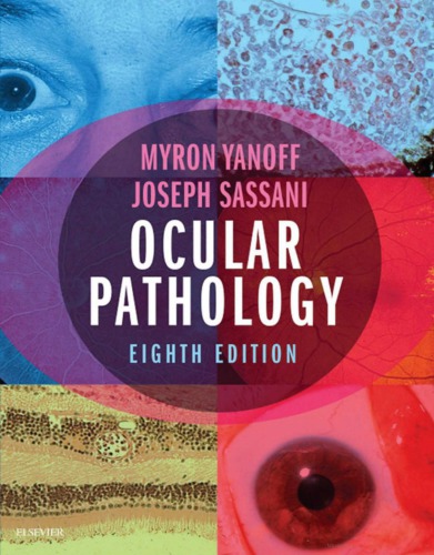 Ocular Pathology 8th Edition Myron Yanoff Joseph Sassani