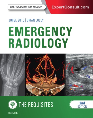Emergency Radiology The Requisites Second Edition Lucey Brian C Soto
