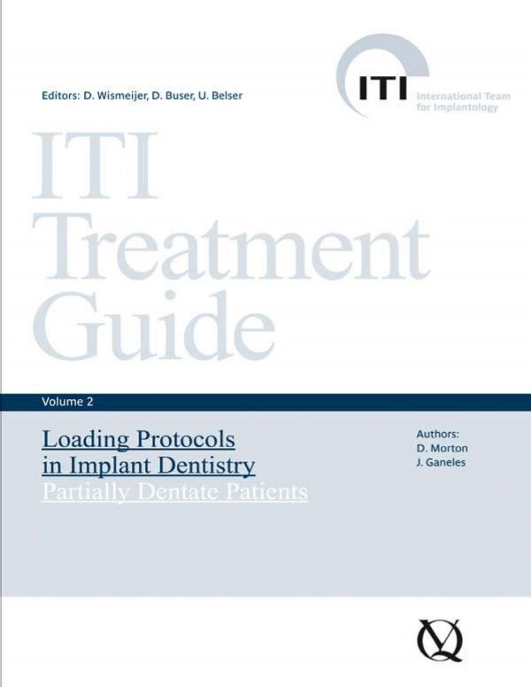 Iti Treatment Guide 2 D Morton J Ganeles