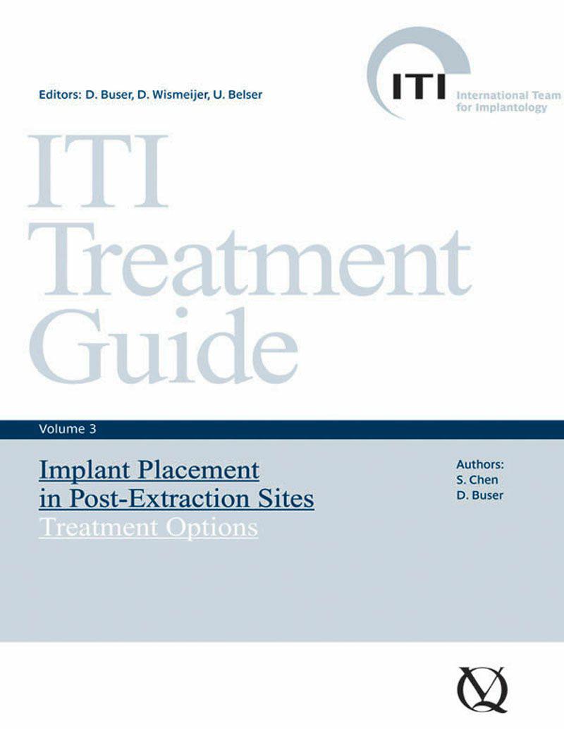 Iti Treatment Guide 3 S Chen D Buser