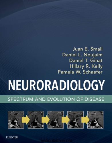 Neuroradiology Spectrum And Evolution Of Disease 1st Edition Juan Small
