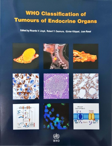 Who Classification Of Tumours Of Endocrine Organs 4th Edition Ricardo V Lloyd
