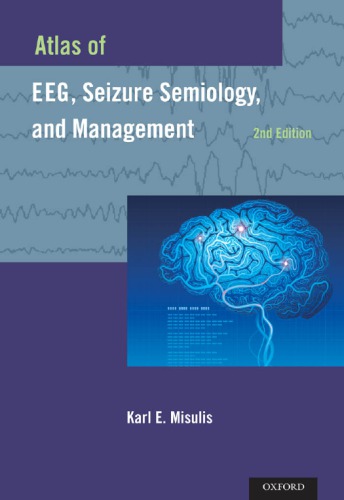 Atlas Of Eeg Seizure Semiology And Management 2nd Edition Karl E Misulis