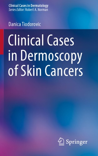 Clinical Cases In Dermoscopy Of Skin Cancers Danica Tiodorovic