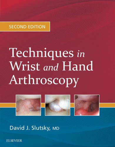Techniques In Wrist And Hand Arthroscopy 2nd Edition David J Slutsky