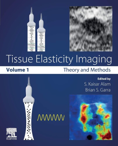 Tissue Elasticity Imaging S Kaisar Alam Brian S Garra