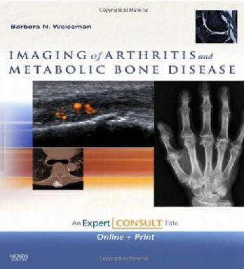 Imaging Of Arthritis And Metabolic Bone Diseasee Barbara N Weissman