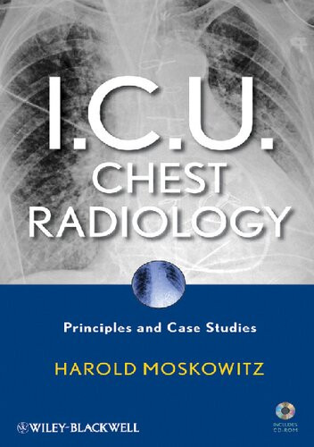 Icu Chest Radiology Principles And Case Studies Harold Moskowitz