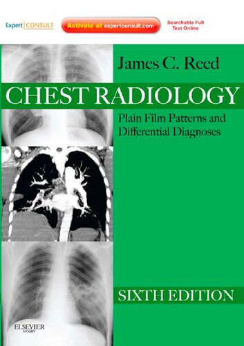 Chest Radiology Plain Film Patterns And Differential Diagnoses 6th Edition James C Reed
