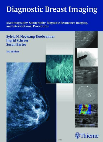 Diagnostic Breast Imaging Mammography Sonography Magnetic Resonance Imaging And Interventional Procedures 3rd Edition Sylvia H Heywangkoebrunner