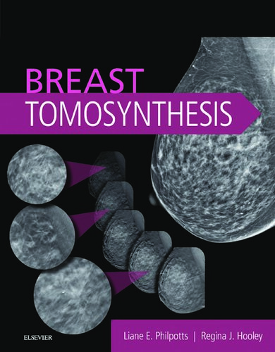 Breast Tomosynthesis 1st Edition Liane E Philpotts Md Facr Regina J Hooley Md