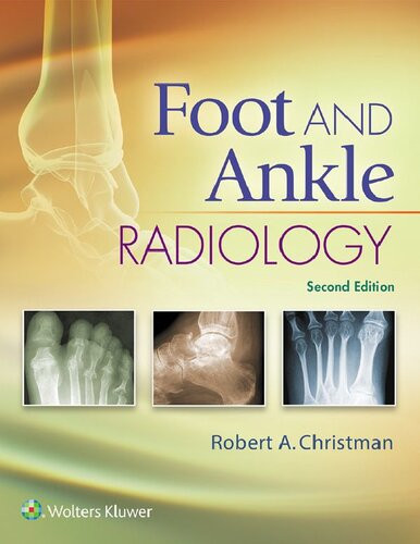 Foot And Ankle Radiology 2nd Edition Robert A Christman